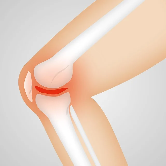 How PT Can Help with Your Knee Replacement How PT Can Help with Your Knee Replacement